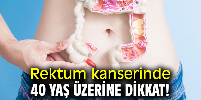 Rektum kanserinde 40 yaş dönüm noktası!