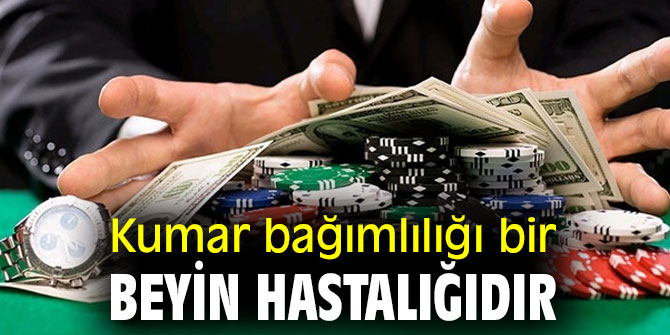 Kumar bağımlılığı bir beyin hastalığıdır