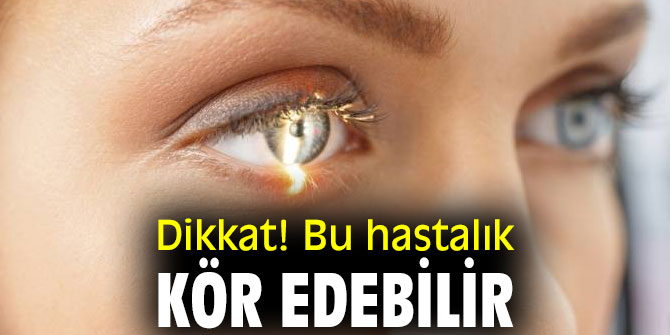 Dikkat! Bu hastalık Kör Edebilir