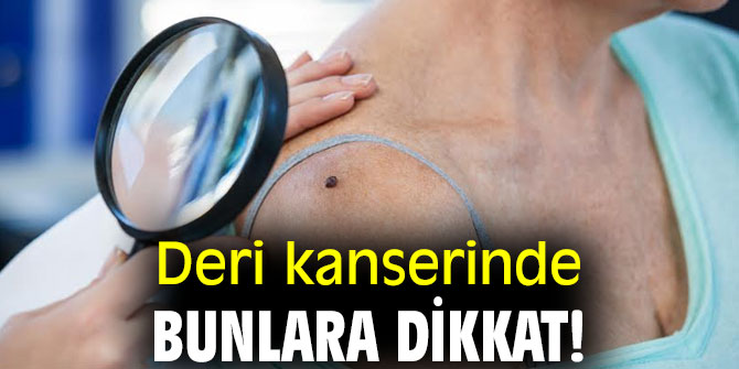 Deri kanserinde bunlara dikkat!