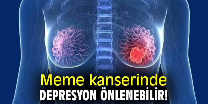 Meme kanserinde depresyon önlenebilir!