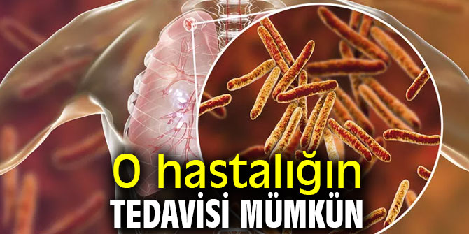 O hastalığın tedavisi mümkün