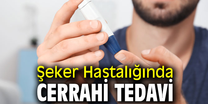 Şeker Hastalığında Cerrahi Tedavi Mümkün