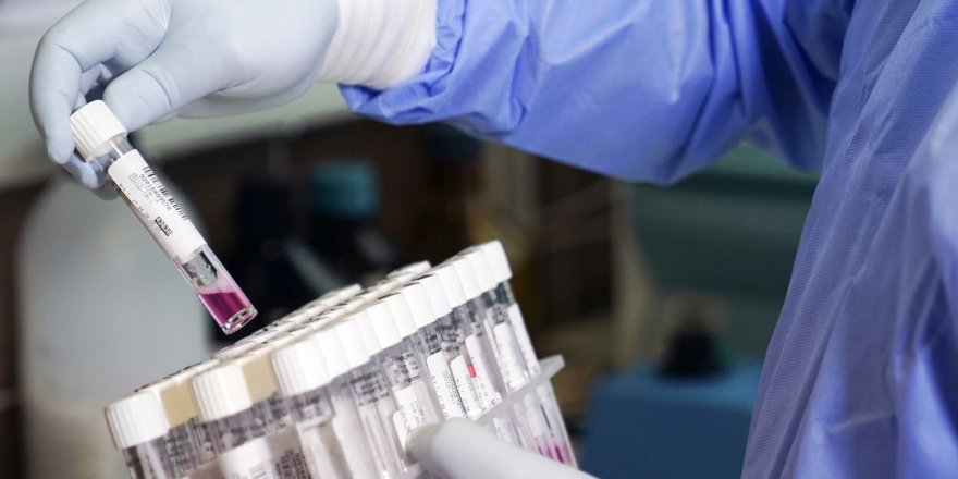 Ege Üniversitesi'nde 200 bin PCR testi