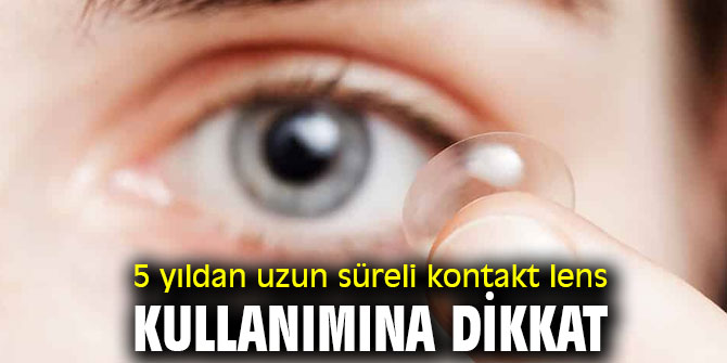Kontakt lens kullanımında düzenli muayene önemli