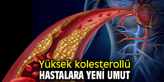 Yüksek kolesterollü hastalara yeni umut