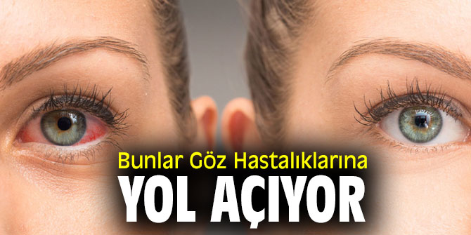 Bunlar Göz Hastalıklarına Yol Açıyor  