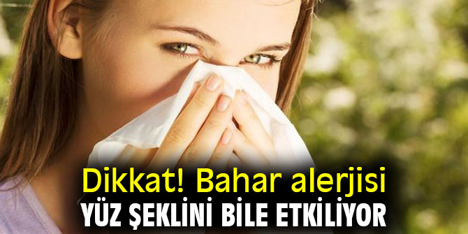Dikkat! Bahar alerjisi, yüz şeklini bile etkiliyor
