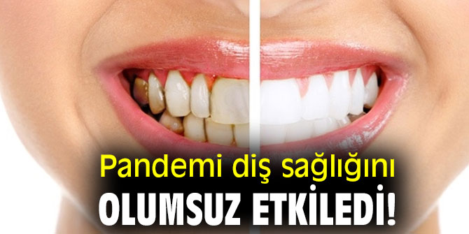 Pandemi diş sağlığını olumsuz etkiledi!