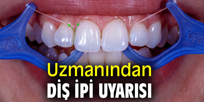 Uzmanından diş ipi uyarısı
