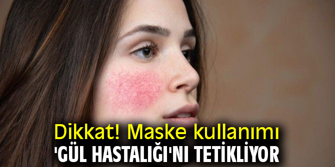 Dikkat! Maske kullanımı 'Gül Hastalığı'nı tetikliyor