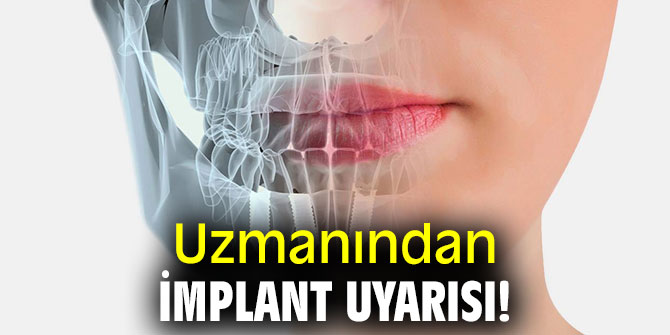 Uzmanından implant uyarısı!