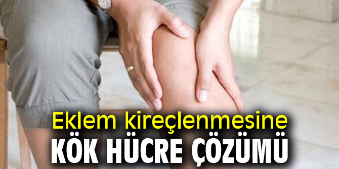 Eklem kireçlenmesine kök hücre çözümü