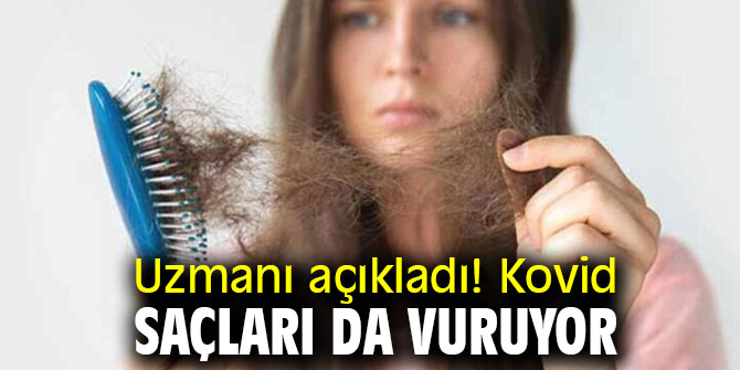 Uzmanı açıkladı! Kovid saçları da vuruyor