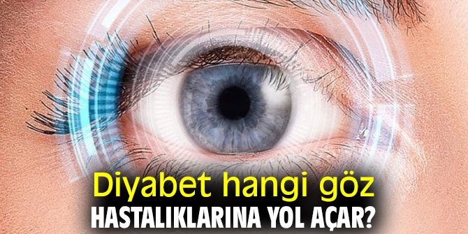Uzmanı açıkladı! Diyabet hangi göz hastalıklarına yol açar? 