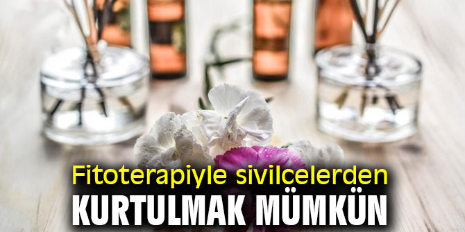 Fitoterapiyle sivilcelerden kurtulmak mümkün