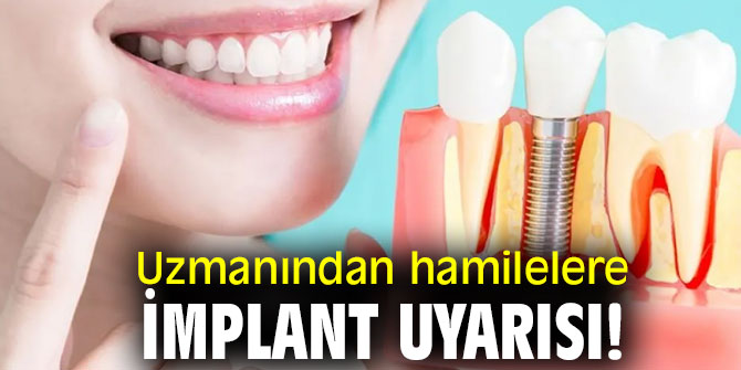 Uzmanından hamilelere implant uyarısı!
