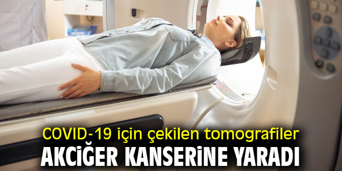 COVID-19 için çekilen tomografiler akciğer kanserine yaradı