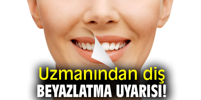 Uzmanından diş beyazlatma uyarısı!