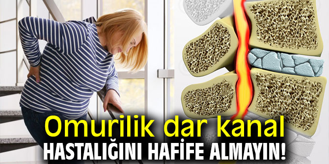 Uzmanı uyardı! Omurilik dar kanal hastalığını hafife almayın!