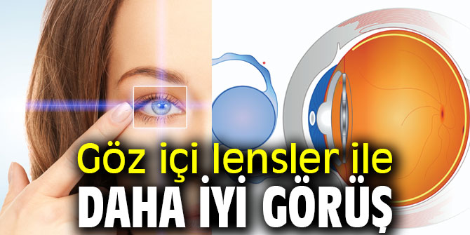 Dikkat! Göz içi lensler ile daha iyi görüş