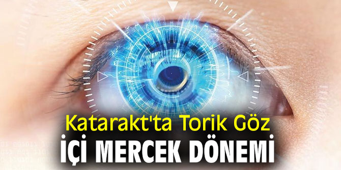 Katarakt'ta Torik Göz İçi Mercek Dönemi