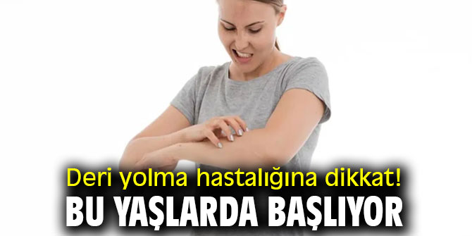 Deri yolma hastalığına dikkat! Bu yaşlarda başlıyor