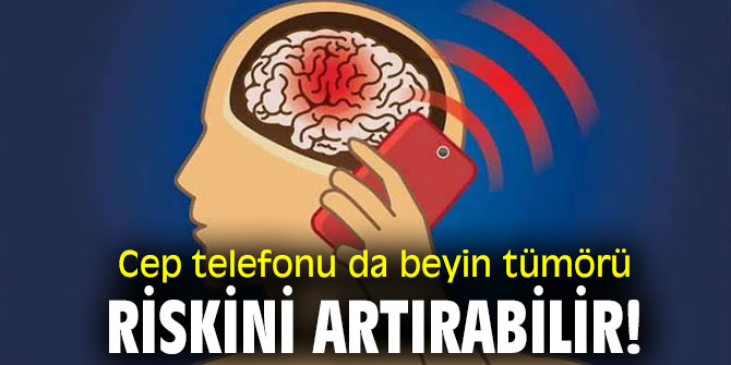 Uzmanı açıkladı! Cep telefonu da beyin tümörü riskini artırabilir!