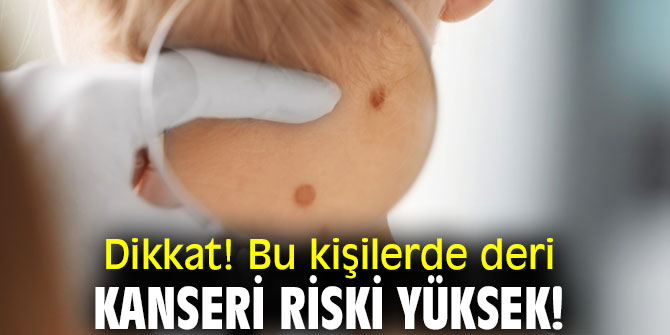 Dikkat! Bu kişilerde deri kanseri riski yüksek!