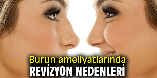 Uzmanı açıkladı! Burun ameliyatlarında revizyon nedenleri