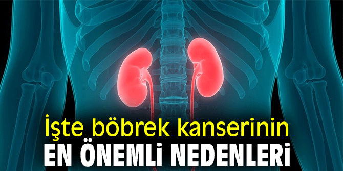 İşte Böbrek Kanserinin En Önemli Nedenleri