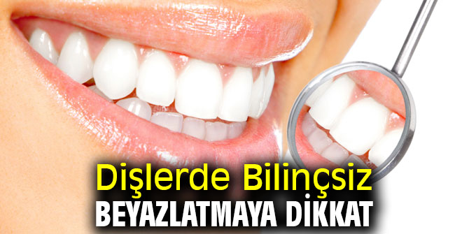 Dişlerde Bilinçsiz Beyazlatmaya Dikkat