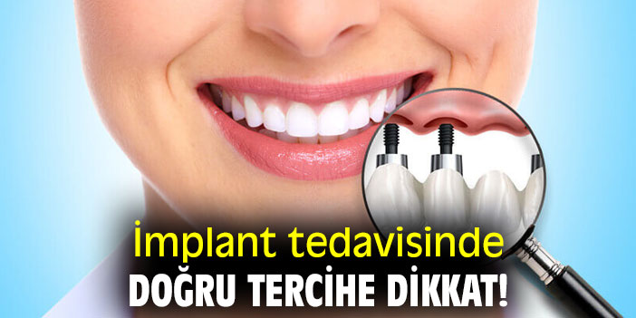 İmplant tedavisinde doğru tercihe dikkat!