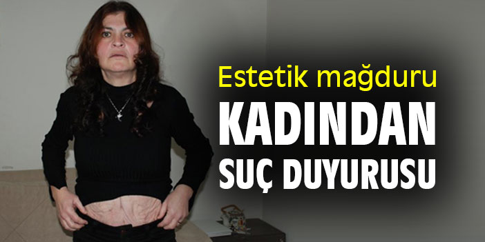 Estetik mağduru kadından suç duyurusu
