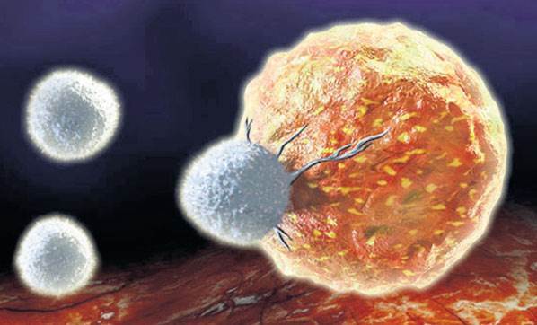 Kansere robotik cerrahiyle darbe