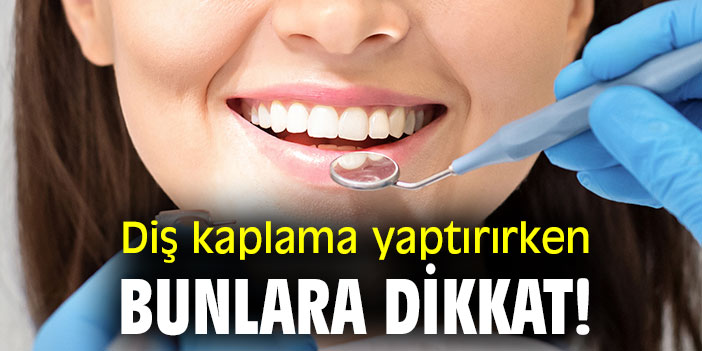 Diş kaplama yaptırırken bunlara dikkat!