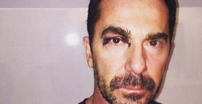 İlker İnanoğlu'nun Hali Şok Etti!