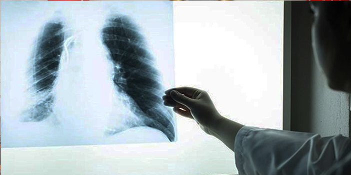 'Akciğerimizi Okuyoruz' sonuçları açıklandı