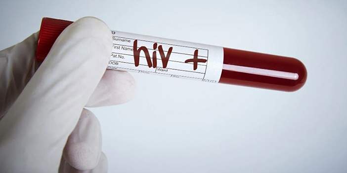 'HIV'de, sağlık okuryazarlığı çok önemli!'