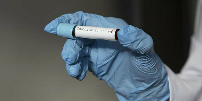 Koronavirüsü erkekler daha ağır geçiriyor