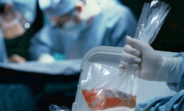 Organ bağışı uygulaması ülkeyi karıştırdı!