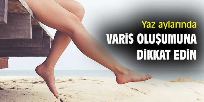 Yaz aylarında varis oluşumuna dikkat edin!