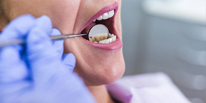 Ağız sağlığı için 5 alışkanlık