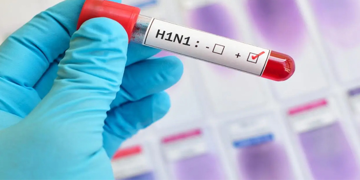 H1N1 Virüsü nasıl bulaşır?