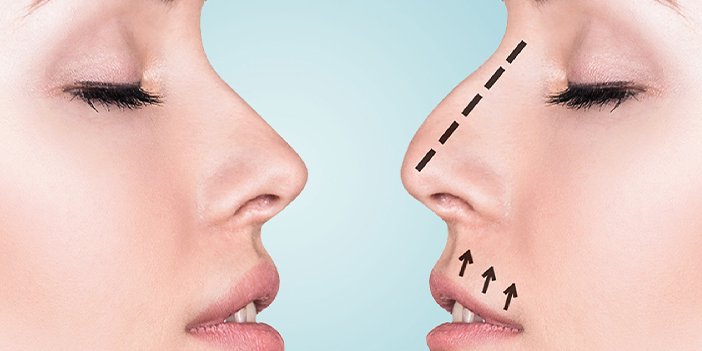 Estetik bir görünüme kavuşmak mümkün