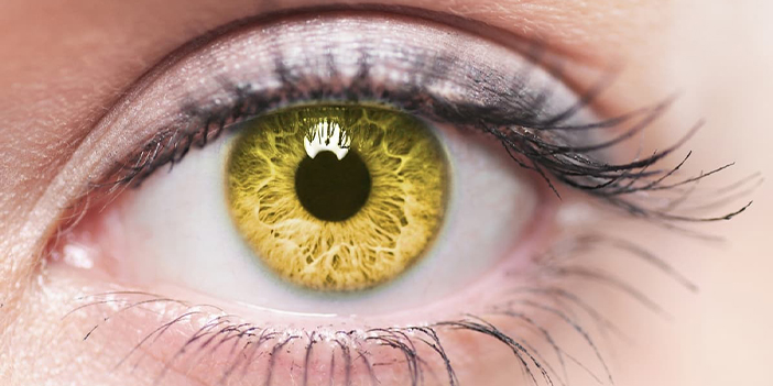 Sarı noktadan kurtulabilirsiniz