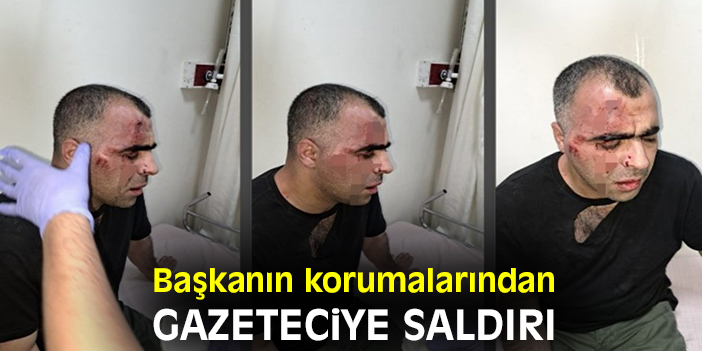 Başkanın korumalarından gazeteciye saldırı