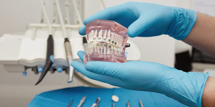 Diş teli bakımı nasıl olmalı?