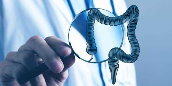 Divertikülit belirtileri nelerdir?