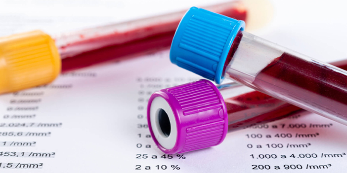 HIV virüsü yayılıyor mu?